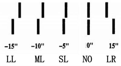 Influence of biased feedback on performance in a Vernier discrimination task